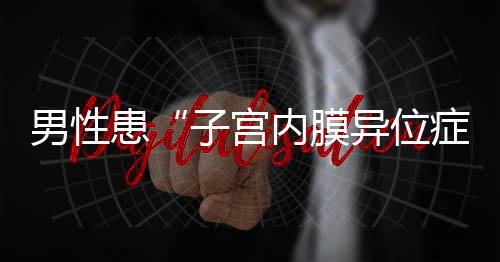 其中居然有64例男性患者