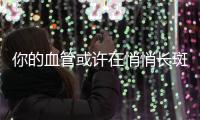 你的血管或许在悄悄长斑
！这样做，“斑块”可能缩小→