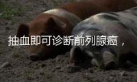 抽血即可诊断前列腺癌，拜登为何不测
	？