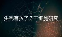 头秃有救了
？干细胞研究阐明压力如何影响毛发生长