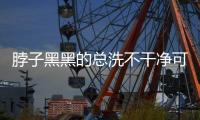 脖子黑黑的总洗不干净可能是病了，这些疾病信号赶紧自查