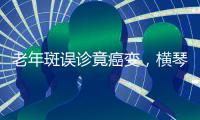老年斑误诊竟癌变，横琴医院提醒
：医学美容需科学诊断与规范治疗